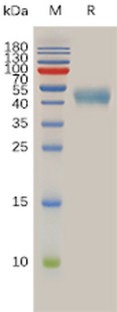 Human MERTK Protein蛋白, His Tag