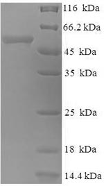 E. coli hph Protein蛋白，orb24476