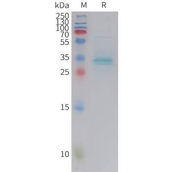 Human CXCL14 Protein蛋白，orb1471