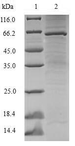 Human SSB Protein蛋白，orb358125，