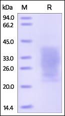 Human PTH1R Protein蛋白, His Tag