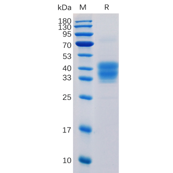 Human CSF1R Protein蛋白, His Tag