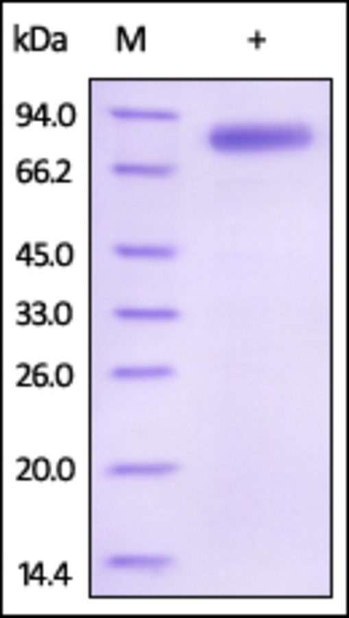 IL12 B 重组蛋白，orb1227945，biorbyt