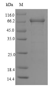 Human MSH6 Protein蛋白，orb246398