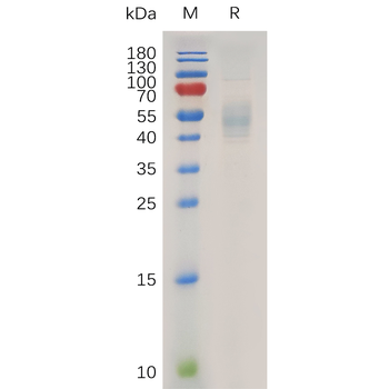 Human Galectin 9 Protein蛋白, hF