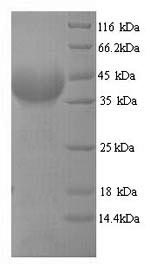 Yeast MDR1 Protein蛋白，orb246812