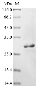 BK polyomavirus Small t antige