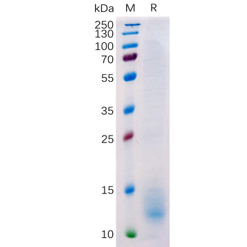 Human CD32A (H167) Protein蛋白, 