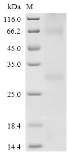 重组蛋白 Human Melanocortin recept