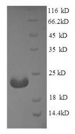 Human C19orf80 Protein蛋白，orb24