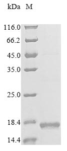 重组蛋白 Human C-C chemokine recep