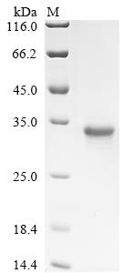 重组蛋白 Human Melanotransferrin (