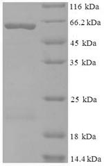 Human CCBL1 Protein蛋白，orb24480