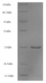 E. coli PTH Protein蛋白，orb35834