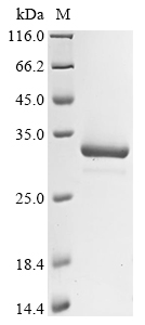nanA Protein蛋白，orb1477234，bior