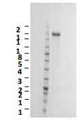 Human SARS-CoV-2 trimeric solu