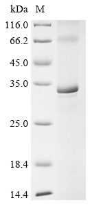 重组蛋白 Mouse E3 ubiquitin-protei