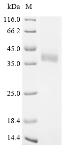 重组蛋白 Human Deoxyribonuclease-1