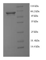 E.coli gluD Protein蛋白，orb24650