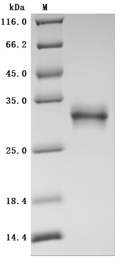 重组蛋白 Human Oncostatin-M (OSM),
