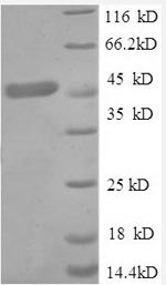Human TNFR1 Protein蛋白，orb24532