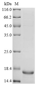 Feline coronavirus Spike glyco