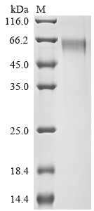 重组蛋白 Human Syntenin-1 (SDCBP)，