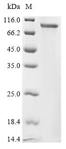 重组蛋白 Mouse Voltage-dependent L