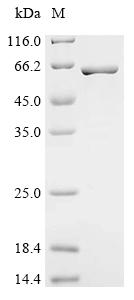 重组蛋白 Mycobacterium tuberculosi