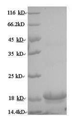 Yeast IL10 Protein蛋白，orb245881