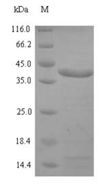 Bacterial spi Protein蛋白，orb358