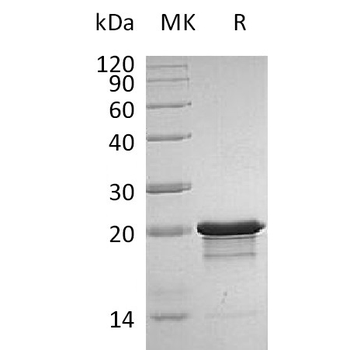 Human GPR64 Protein蛋白, His Tag