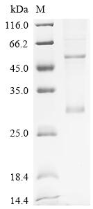 重组蛋白 Human Ras-related Protein