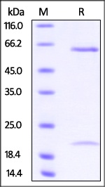 PCSK9 重组蛋白，orb1227806，biorbyt