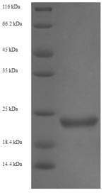 E.coli stxB Protein蛋白，orb24624
