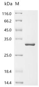 重组蛋白 Cowpea chlorotic mottle v