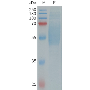 Human FCRL5(745-847)Protein 蛋白