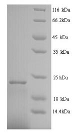 Human IFNA2 Protein蛋白,orb24610