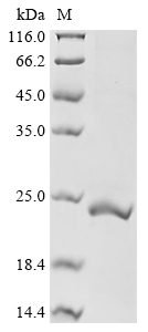 Human UCN3 Protein蛋白,orb147731