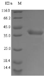 Bacterial ldhA Protein蛋白，orb35