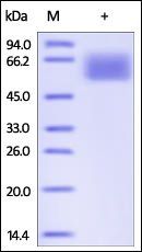 Human TGF-beta RII Protein蛋白,