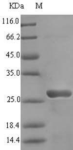 Bacterial albA Protein蛋白，orb35