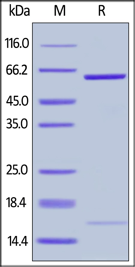 PCSK9 (D374Y) 重组蛋白，orb1227928，