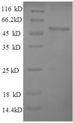 Yeast PYC1 Protein蛋白，orb246058