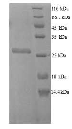 E. coli fkpA Protein蛋白，orb3582