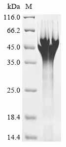 重组蛋白 Human B-cell CLL/lymphoma
