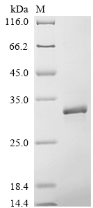 重组蛋白 Hepatitis B virus genotyp
