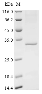 重组蛋白 Human Serine/threonine-pr