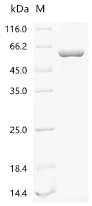 重组蛋白 Mouse Histone deacetylase