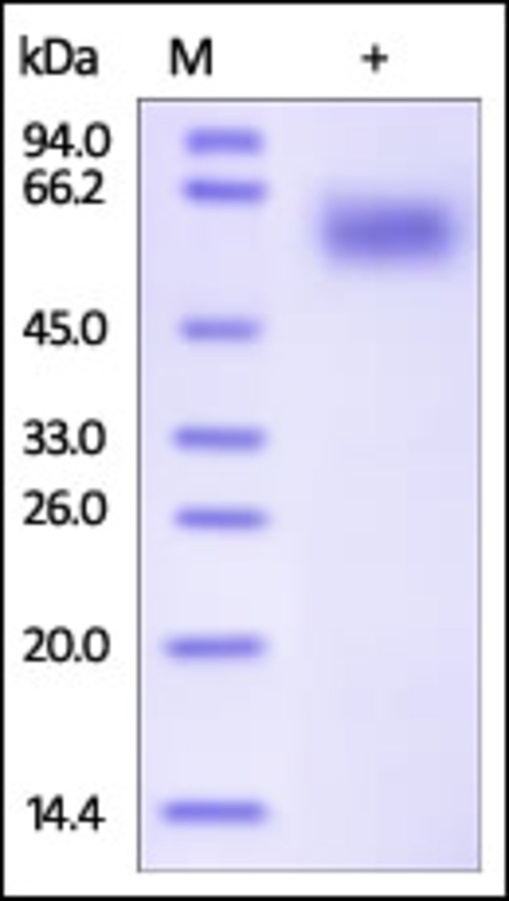 IL1R3 重组蛋白，orb1227982，biorbyt